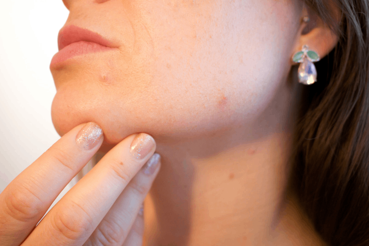 Skin care